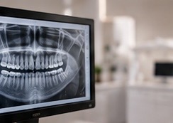 Digitális fogászati diagnosztika